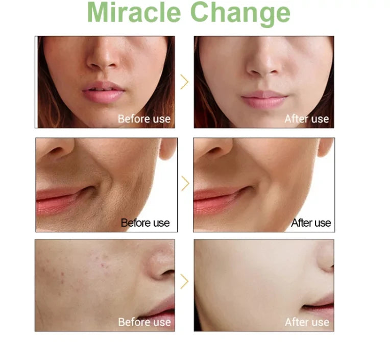 Serum Wrinkle 2.5% Aging Retinol Reducing Anti And